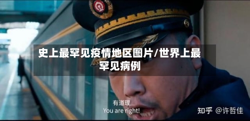 史上最罕见疫情地区图片/世界上最罕见病例